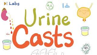 Urine casts (WBCs, RBCs, Waxy, Hyaline, Granular, Epithelial, Fatty)