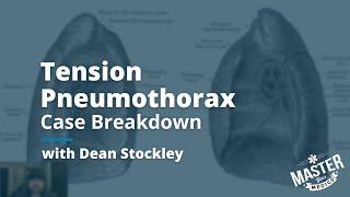 Tension Pneumothorax | Case Breakdown (August 30th, 2024)