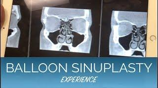 Balloon Sinuplasty, Septoplasty,  and Turbinate Reduction - EXPERIENCE and COST breakdown