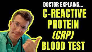 Doctor explains C-reactive protein (CRP) blood test!