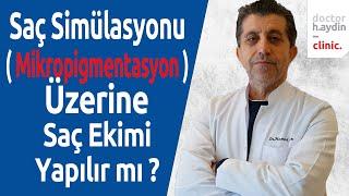 Saç Simülasyonu ( Mikropigmentasyon ) Üzerine Saç Ekimi Yapılır mı?  - Dr. Hamid AYDIN