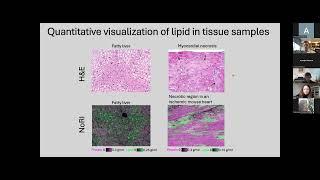 W.Trim,L.Peshkin,K.Petrova "Understanding Tissue Biology using Normalised Raman Imaging (NoRI)"