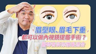 內視鏡提眉 vs. 拉皮手術的差別？眉壓眼 眉毛眼尾下垂 你可能需要提眉手術！《葉氏一二三》｜凡登整形外科 葉亘耕醫師