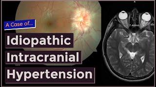 Idiopathic Intracranial Hypertension