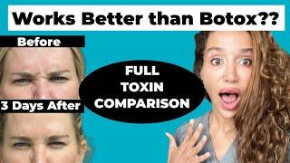 BRAND NEW 2023 Botox Alternative that LASTS Longer! Daxxify - The Longest lasting Toxin