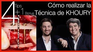  [Técnica de Khoury] Regeneración Ósea en Implantes Dentales -Formación en Implantología y Cirugía