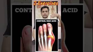 2 Best Exercises for Control URIC ACID #shorts