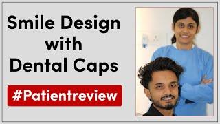 Smile Design with Dental Caps | Patient Review | Seraphic Dental, Indore