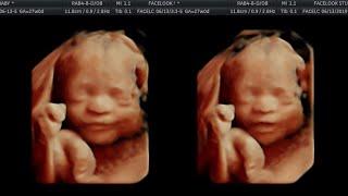 OUR BABY'S 4D ULTRASOUND | 27 WEEKS PREGNANT