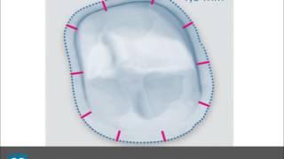 How to achieve ideal preparations for successful all-ceramic crown restorations