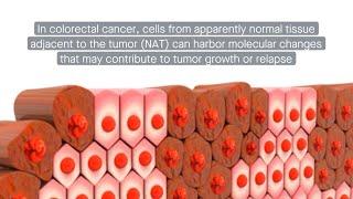 The cells next door: Tumor-adjacent stem cells drive inflammation and fibrosis in colorectal cancer