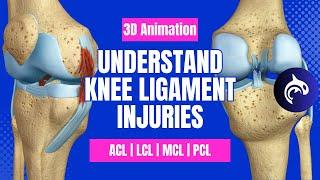 Understand Knee Ligament Injuries (ACL, PCL, MCL, LCL) - 3D animation