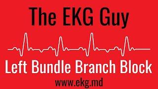 Left Bundle Branch Block (complete) on EKG / ECG l The EKG Guy - www.ekg.md