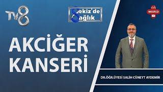 Akciğer Kanseri Nedir? | Dr. Öğr. Üyesi Salih Cüneyt Aydemir | 8'de Sağlık