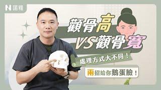 顴骨高和顴骨寬不一樣？Twice Sana也是高顴骨？如何高顴骨又好看？！許修銨醫師｜諾雅整形外科