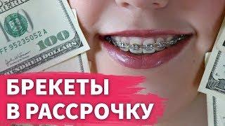 Брекеты  в рассрочку в Москве