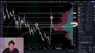 GME about to explode? LPSN Next Targets!