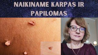 Sveikata | Naikiname karpas ir papilomas