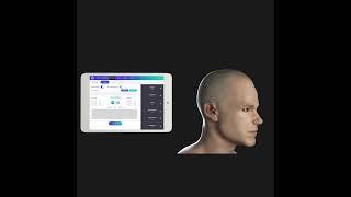 Graft Calculator  #hairtransplant #hairtransplantturkey #saçekimi  #asmed #graftcalculator