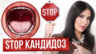 ВОТ, как НЕЛЬЗЯ лечить кандидоз – 4 ошибки. Как избавиться от кандиды?