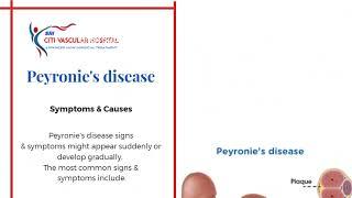 Peyronie’s Disease: Causes & Symptoms