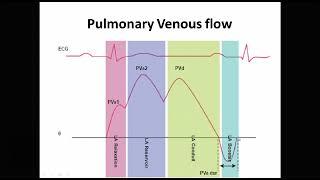 Traces - 6 Pulmonary Venous Flow