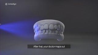 Orthodontic Specialists of Lake County | OSOLC Invisalign Orthodontist Gurnee & Antioch, IL