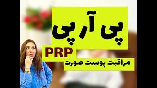 مراقبت از پوست :پی آر پی و بایدها و نبایدها #پی_آر_پی