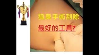 狐臭小教室- 第二十二堂 :  狐臭手術刮除最好的方法是甚麼?