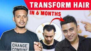 Hair Transformation Kolkata (Before AFTER) #hairtransplantindia