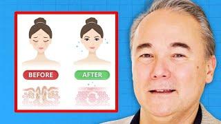 Cómo ELIMINAR Arrugas (Remedio Natural) | Dr. William Davis