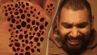 TRYPO VIRUS (TRYPOPHOBIA SHORT HORROR FILM)