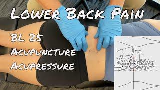 BL 25 Acupressure: Low Back Pain