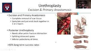 IVUmed & St. Lucia: Urethral Strictures and Urethral Reconstruction