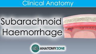 What is Subarachnoid Haemorrhage? | Clinical Anatomy