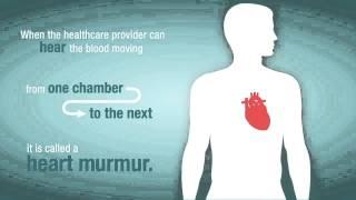 What is a Heart Murmur and How Does it Relate to Valve Problems?