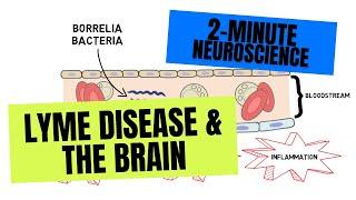 2-Minute Neuroscience: Lyme Disease & the Brain