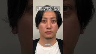 黒クマは"脱脂"じゃなくて"注入"でも治せます！#東京美容外科 #目元整形 #脱脂 #脂肪注入 #くまとり