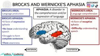 69 SECONDS on BROCA'S and WERNICKE'S APHASIA (Never get them mixed up again!)