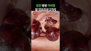 당장 병원 가야할 암 전조증상 5가지 #건강정보 #건강