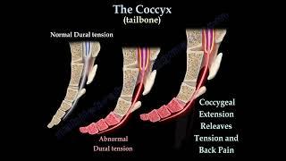Coccydynia , coccyx pain  coccyx pain causes, diagnosis and treatment