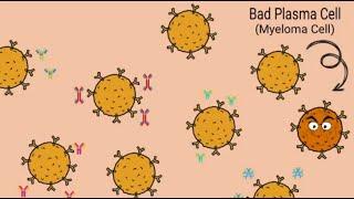 Let's Talk About Monoclonal Proteins