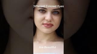 Different colors eyes are so gorgeous and I hope you love the #beautiful #beauty #insecurity#eyes