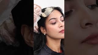 Become Dandruff-Free With This Treatment | VCare Hair And Skin Clinics