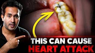 HIDDEN Cause of HEART ATTACK Nobody Knows About