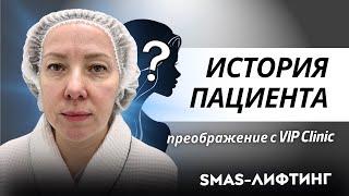 Смас-лифтинг. Пластический хирург Круглик Сергей Викторович