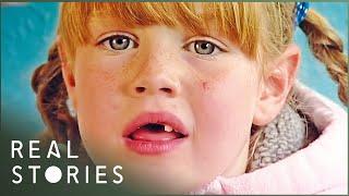 Children With Body Dysmorphia: Skinny Kids (Mental Health Documentary) | Real Stories