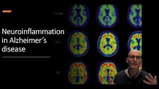 Neuroinflammation in Alzheimer's Disease: The Role of Microglia