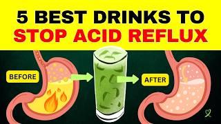 5 Best Drinks To Stop Acid Reflux