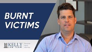 Personal Injury Attorney Shares Tips on Burn Injuries | Kelly Law Team